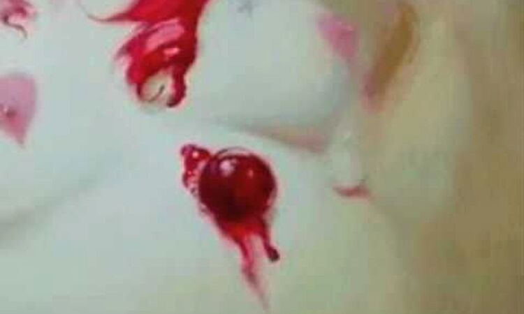 Collage - Halb Sirp (Bad Sickle)